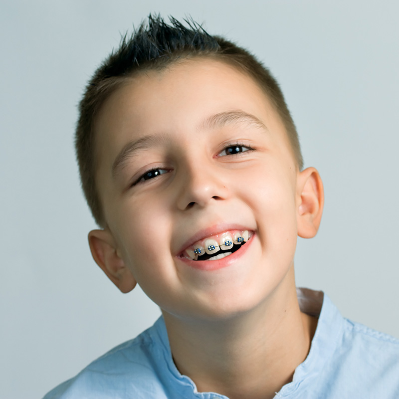 The image shows a young boy with a wide smile, displaying his braces and teeth, against a plain background.